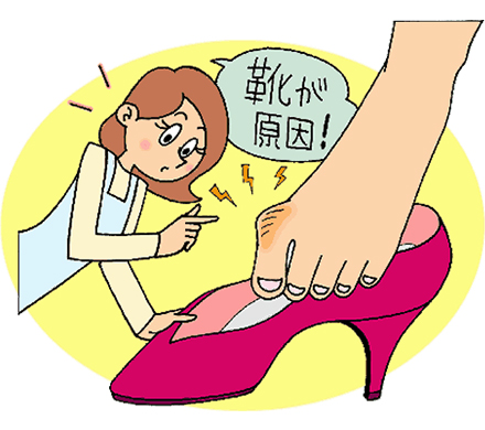 外反母趾と靴の選び方