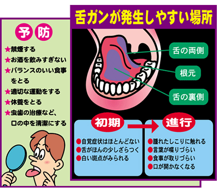 の 痛い ベロ 付け根